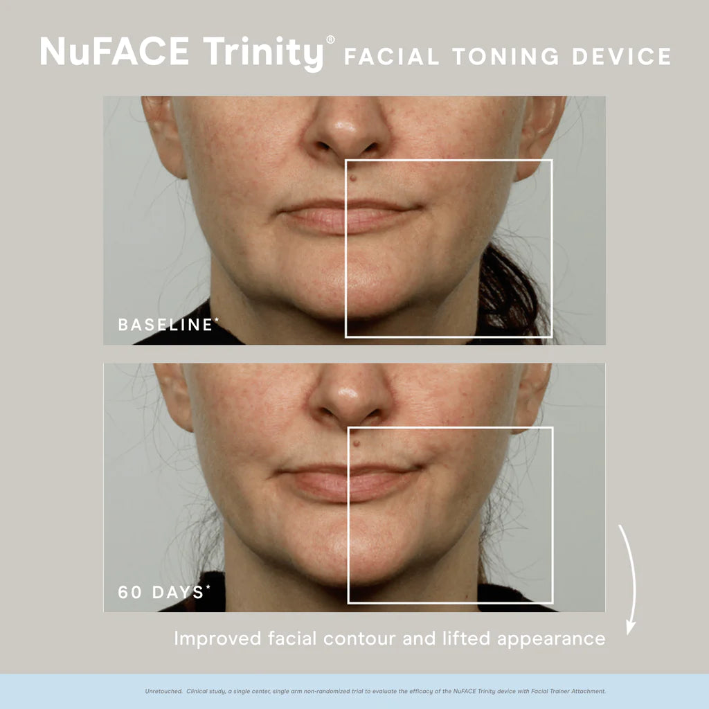 NuFACE Trinity® Starter Kit